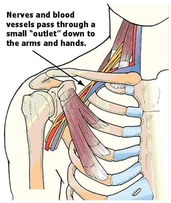 腕の痛み・痺れ・脱力感など「胸郭出口症候群」では有りませんか？サムネイル